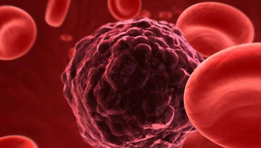 Los tumores eligen a qué órgano irá la metástasis y preparan el terreno