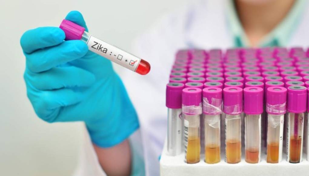 La vista alterada podría ser la primera señal de daños por el Zika en los bebés