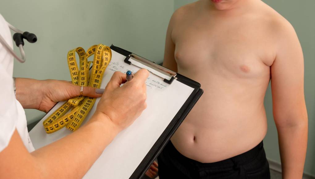 Uno de cada tres adolescentes es obeso en Honduras