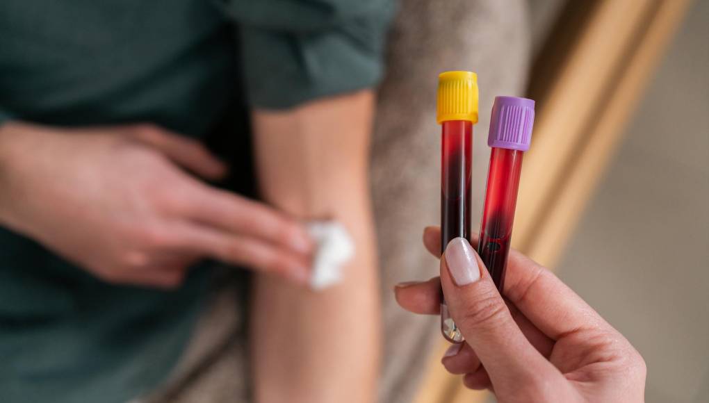 FDA actualiza recomendaciones para donar sangre