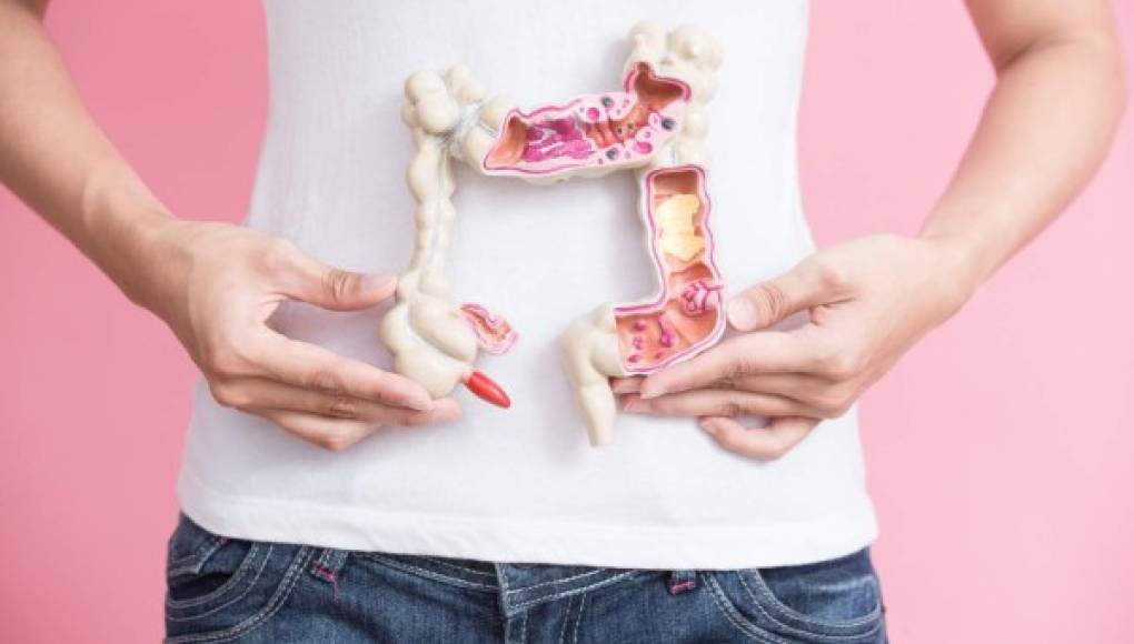 Alteraciones intestinales pueden ser señales de cáncer de colon