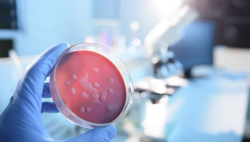 No hay fármacos contra el ébola