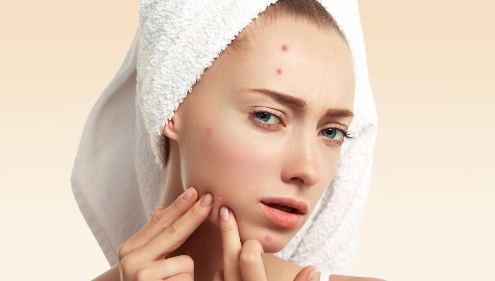 ¿Cómo evitar una erupción cuando haga ejercicio?