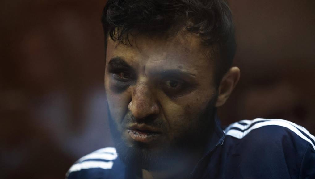 De acuerdo con los últimos datos oficiales, el atentado en la sala de conciertos Crocus City Hall, a 20 kilómetros del centro de Moscú, ha dejado al menos 137 muertos y 182 heridos.