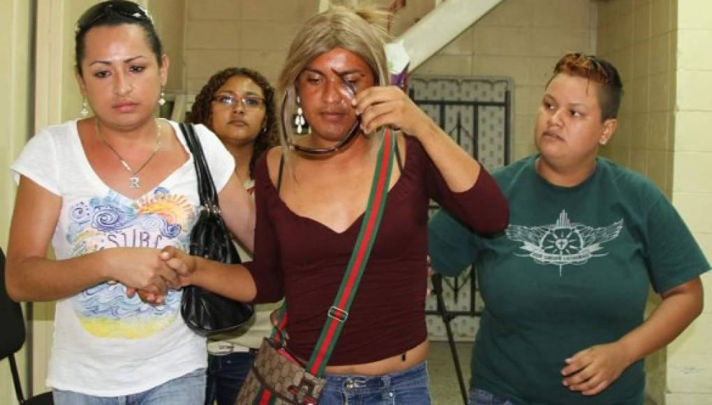 Transexual hondureño golpeado por médico denuncia amenazas