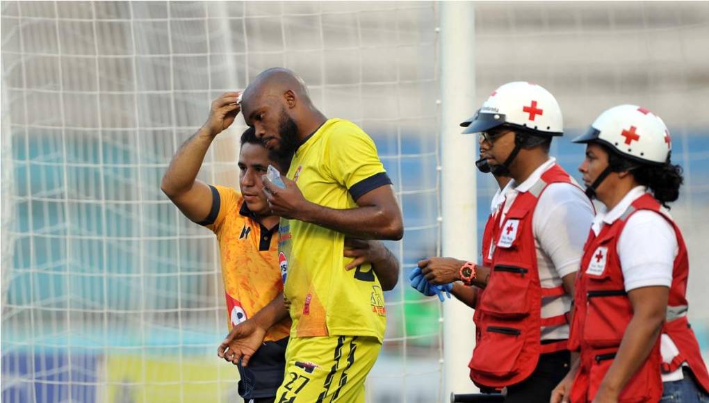 El defensa del Génesis, Juan Diego Lasso, sufrió un corte en su cabeza tras un duro choque en el primer tiempo.