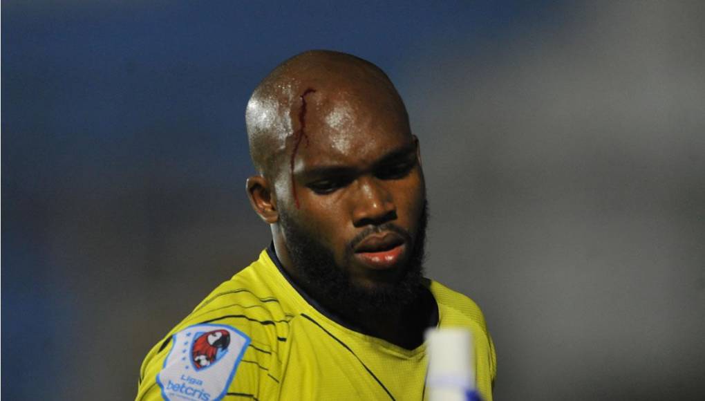 Juan Diego Lasso tuvo que salir del campo para ser atendido debido a que su corte en la cabeza se abrió y estaba sangrando.