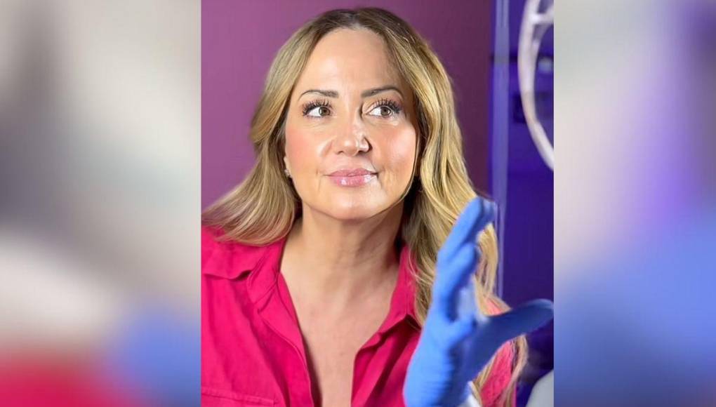 Además de ello, Legarreta mencionó que también recibió una pequeña cantidad de toxina botulínica, conocida popularmente como bótox para evitar la formación de arrugas en su piel. Ella lo describió como “un baby bótox”, diseñado para no ser tan evidente e invasivo.