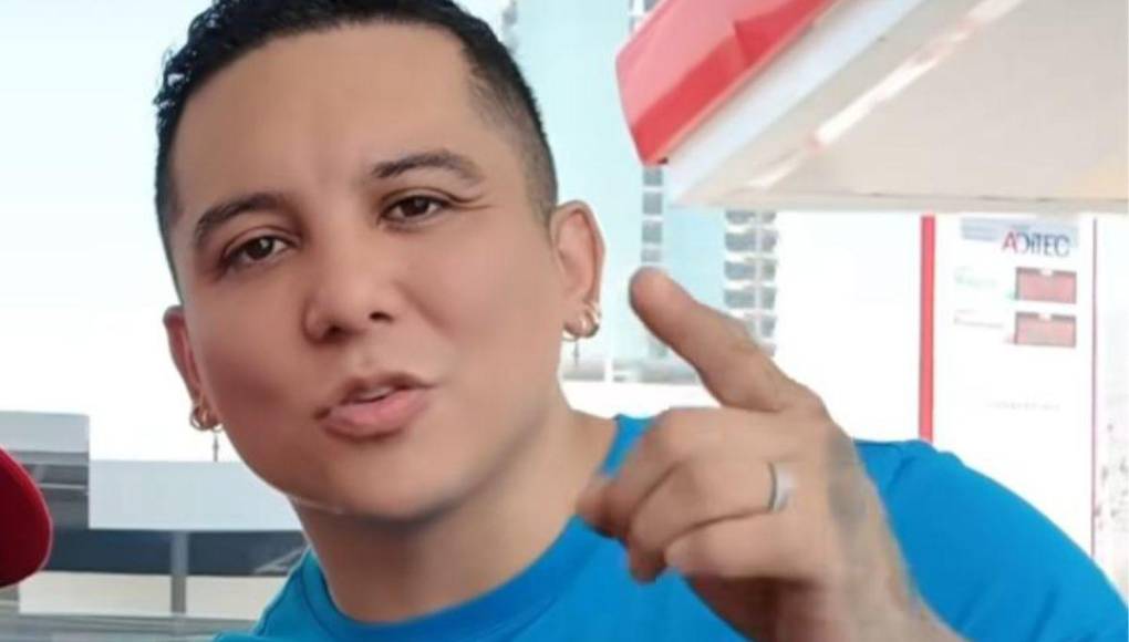 Sin embargo, en 2022, dejó el bótox para probar un tratamiento llamado “emface”, que se enfoca en fortalecer los músculos faciales y dar firmeza a la piel. Mientras que a finales del mismo año, Edwin Luna compartió que se había sometido a un trasplante capilar para mejorar su aspecto y ocultar la calvicie.