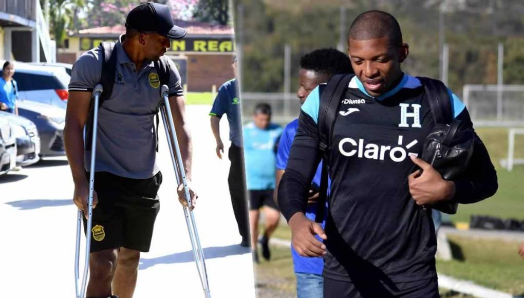 Baja: Debido a su lesión, el portero Luis “Buba” López no fue incluido en la lista preliminar para el duelo ante los ticos.