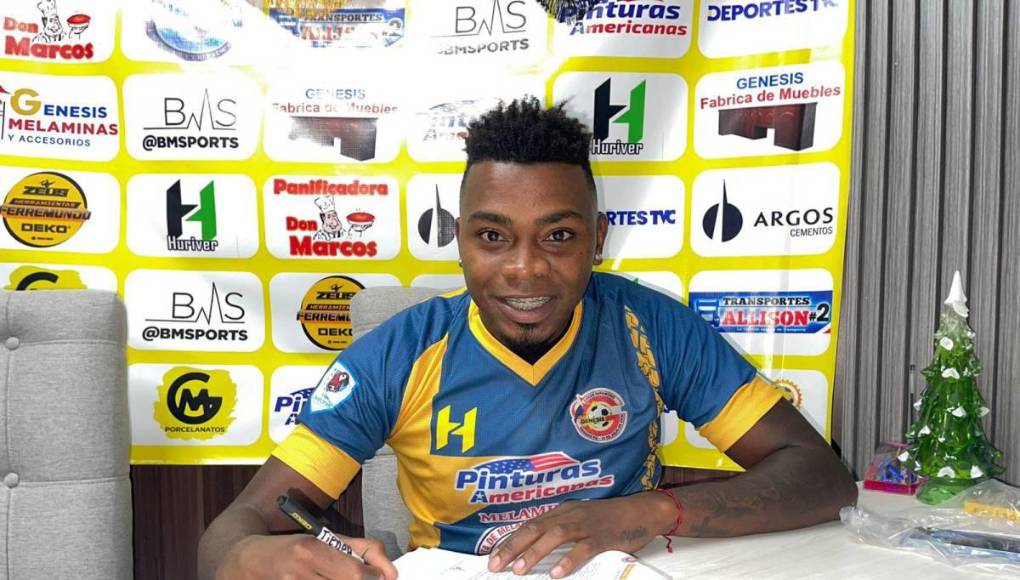 A eso se le añade que el jugador Elmer Güity iba de titular en el partido contra Lobos, pero resulta que el encargado olvidó el carnet del futbolista y por eso no jugó.