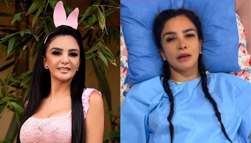 La presentadora mencionó que le inyectaron polímeros y eso le provocó el Síndrome de Asia.