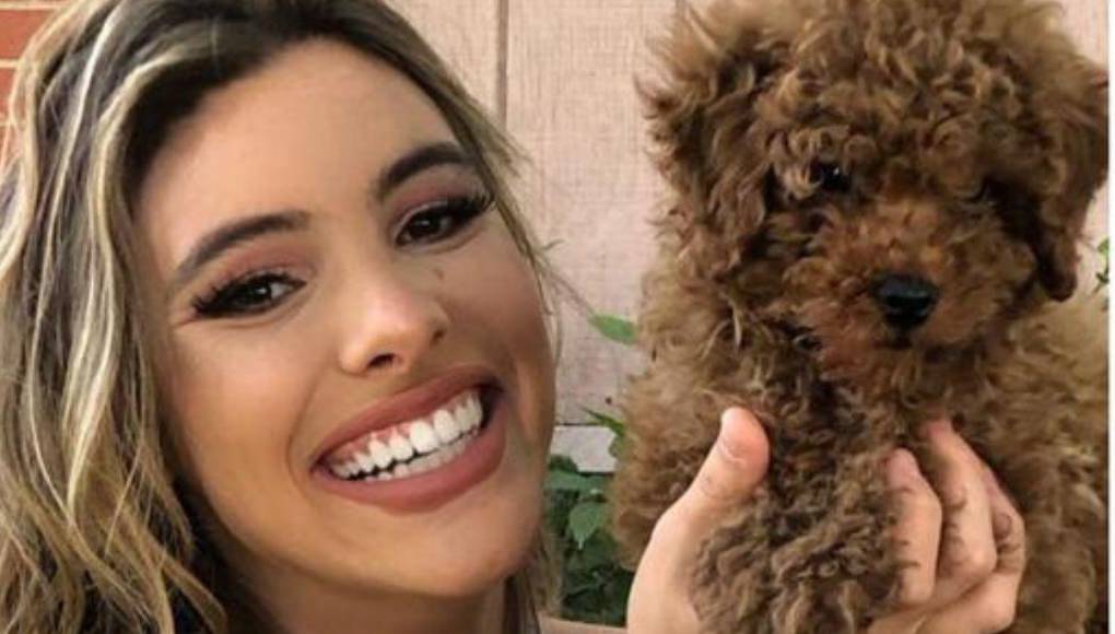 “Vino corriendo hacia mi perro. Agarró a mi perro. En cuanto lo agarró, abrí la boca (y) metí la mano”, narró la venezolana, calificando al pitbull como “tan fuerte”.