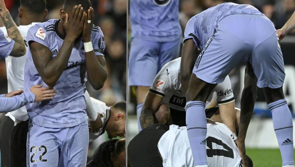 El defensa guineano del Valencia Mouctar Diakhaby, gravemente lesionado el sábado durante el partido de La Liga contra el Real Madrid (2-2), sufre una “luxación de la rodilla derecha”.