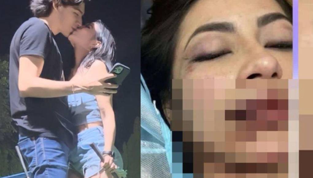 La joven modelo colombiana radicada en Honduras Daniela Aldana ha causado revuelo en redes sociales tras regresar con su novio que supuestamente la agredió físicamente y que paró en un centro asistencial, hoy parecen estar más enamorados.