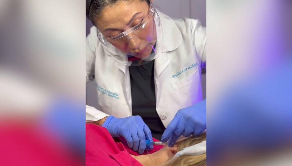 Es precisamente por ello que recientemente sorprendió al dejar ver que se sometió a un procedimiento estético para mantener su piel joven y radiante, a pesar de su temor a las agujas, todo esto en vivo y frente a las cámaras del matutino del que es parte, donde compartió su experiencia con el tratamiento que considera su secreto para una piel firme.