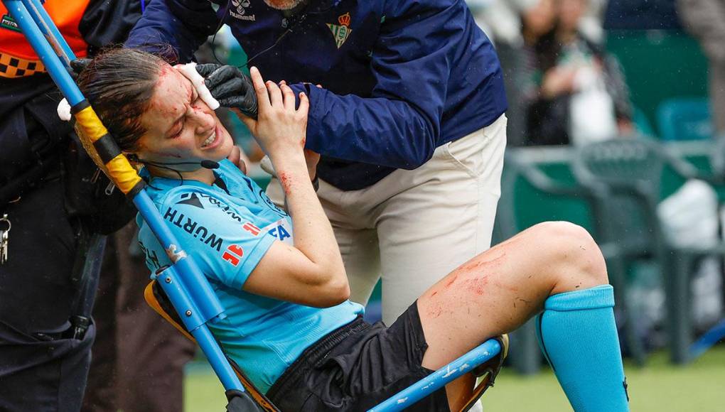 Guadalupe Porras Ayuso, asistente del colegiado Guillermo Cuadra Fernández, tuvo que ser sustituida por el cuarto árbitro del encuentro, Néstor Holgueras Castellanos, al golpearse con una cámara que estaba en las inmediaciones del terreno de juego.