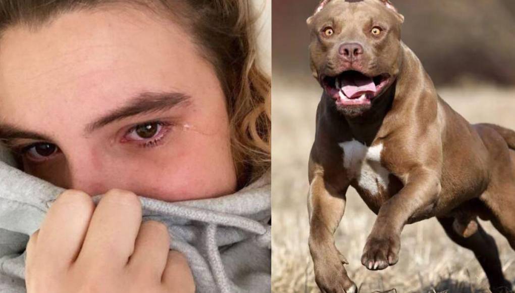 Lele Pons reveló que fue mordida por un pitbull debido a que intervino para evitar que este atacara a su perro de raza poodle.