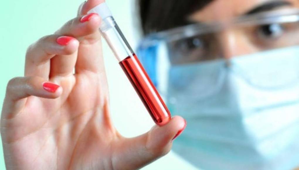 Un análisis de sangre detecta un 86 % de los cánceres de ovarios