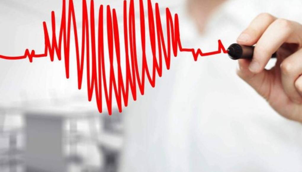 La enfermedad cardiaca no se toma vacaciones
