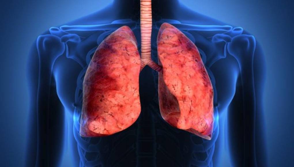 Impresora 3D cura a niños con enfermedades respiratorias