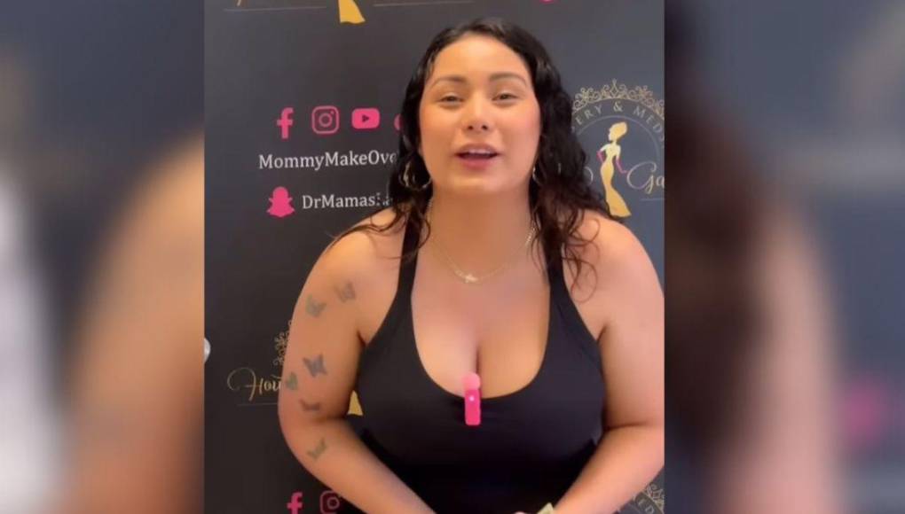 Y muchos salieron a su defensa, asegurando que Elsa luce hermosa y que es normal el proceso que enfrenta debido a la maternidad. 