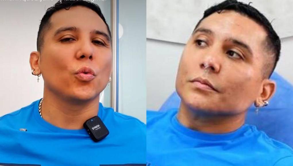 El vocalista de la Trakalosa de Monterrey ha recibido múltiples críticas por su nuevo rostro. 