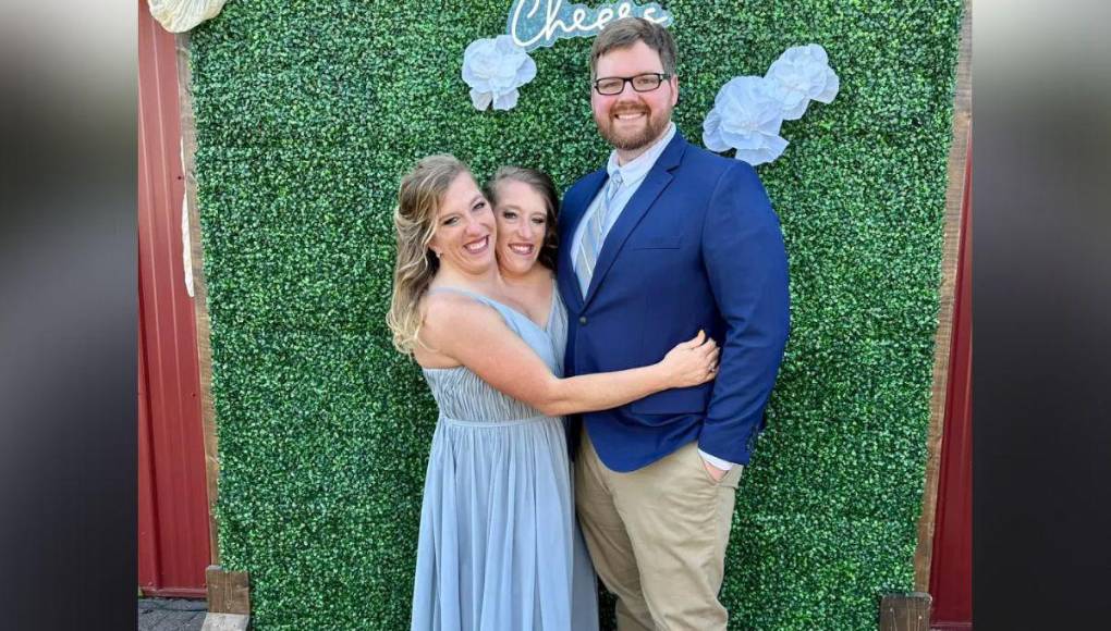 En un mundo donde las historias de amor desafían las convenciones, la de Abby Hensel destaca por su peculiar circunstancia. 