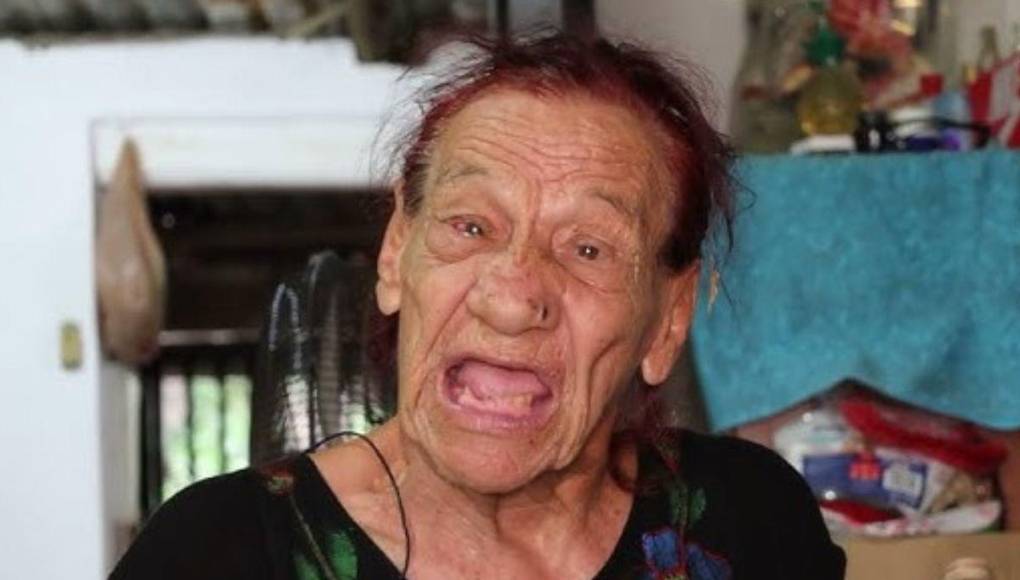 El Secretario de Salud en Sinaloa, Cuitlahuac González Galindo explicó que «La Gilbertona» , tenía cáncer de cabeza y cáncer de cuello por lo que hace un año se realizó una cirugía.