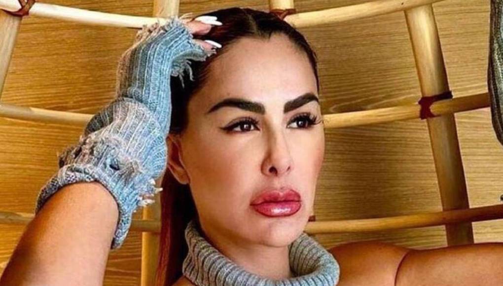 El “Bombón asesino” relató que perdió el conocimiento, se golpeó en la frente y se mordió la lengua del impacto.