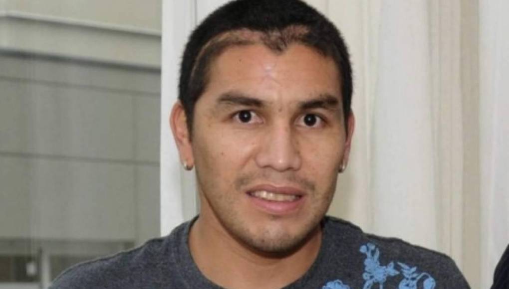 Salvador Cabañas no falleció debido a que el arma de fuego con el que fue agredido era de calibre pequeño.