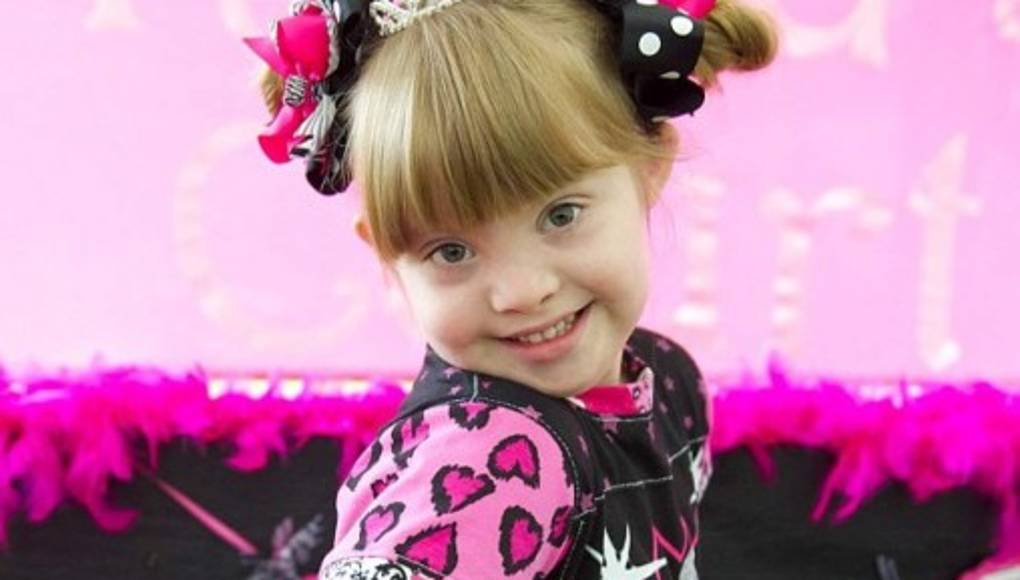 Hermosa modelo con síndrome de Down