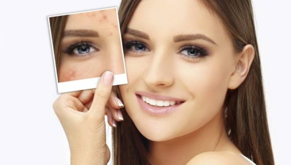 Nuevo tratamiento antiedad