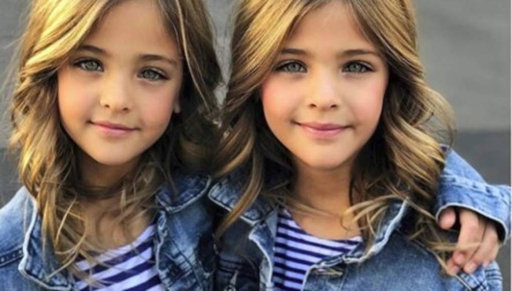 Las gemelas más bellas del mundo