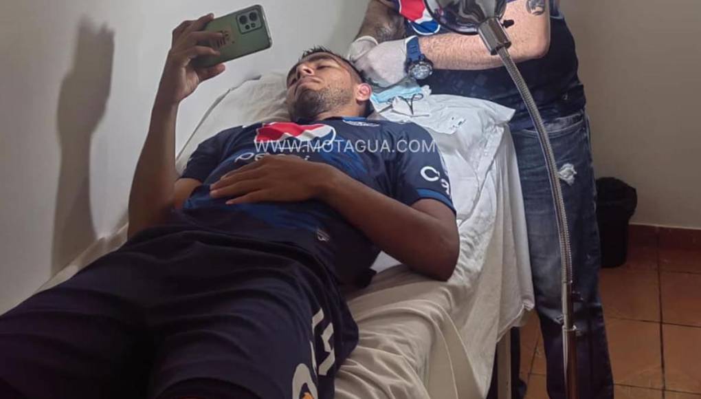 El golpe de Carlos Argueta quedó en un susto. El Motagua confirmó que el jugador “sufrió una pequeña herida en su rostro, donde le realizaron cuatro puntadas”.