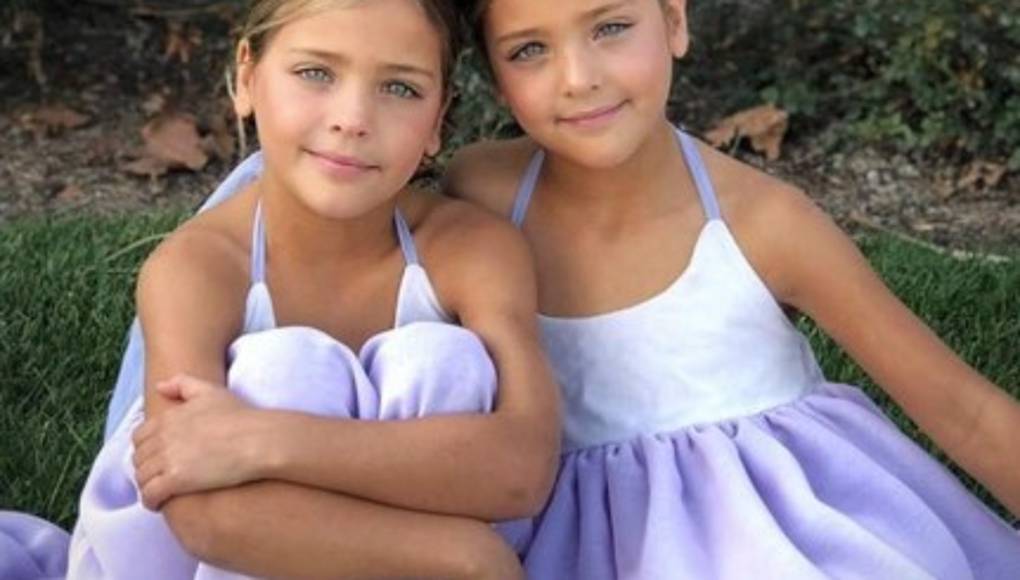 Las gemelas más bellas del mundo