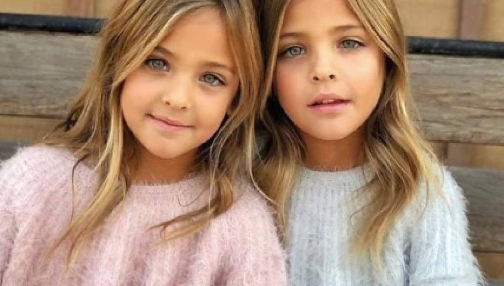 Las gemelas más bellas del mundo