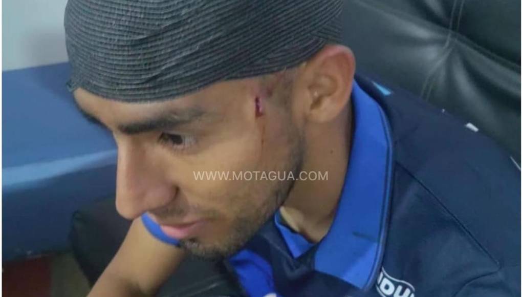 ”El jugador se encuentra estable y fuera de peligro”, comunicó el Motagua sobre Carlos Argueta.
