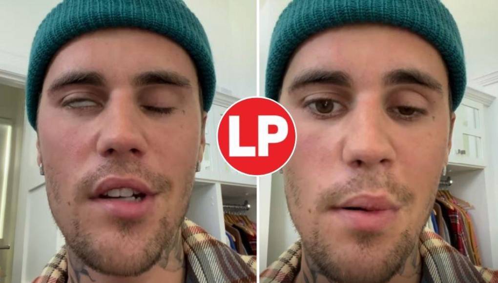 Justin Bieber muestra su rosto afectado tras sufrir parálisis facial