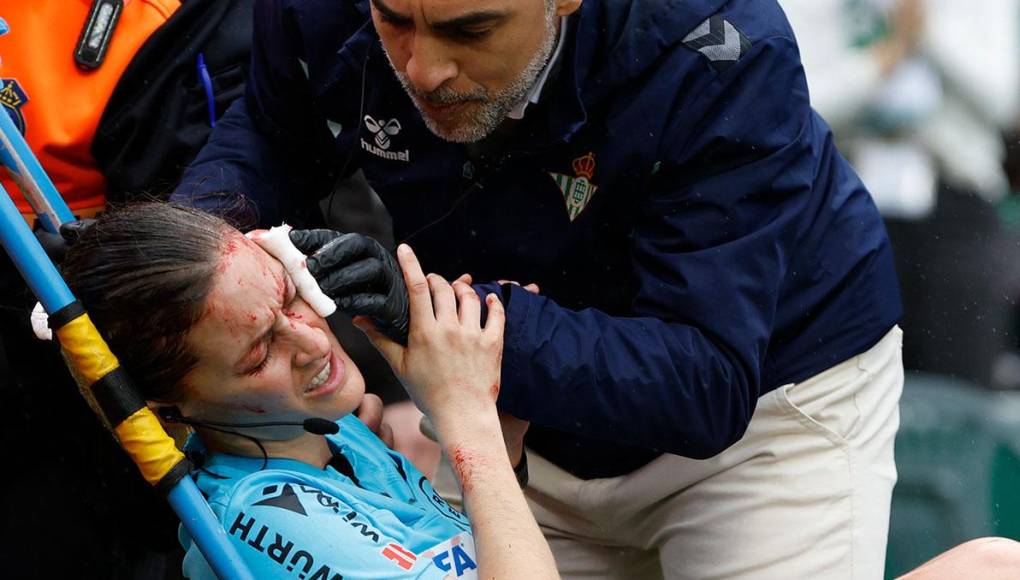 La árbitra Guadalupe Porras sufrió un accidente en pleno juego Betis vs Athletic Club.