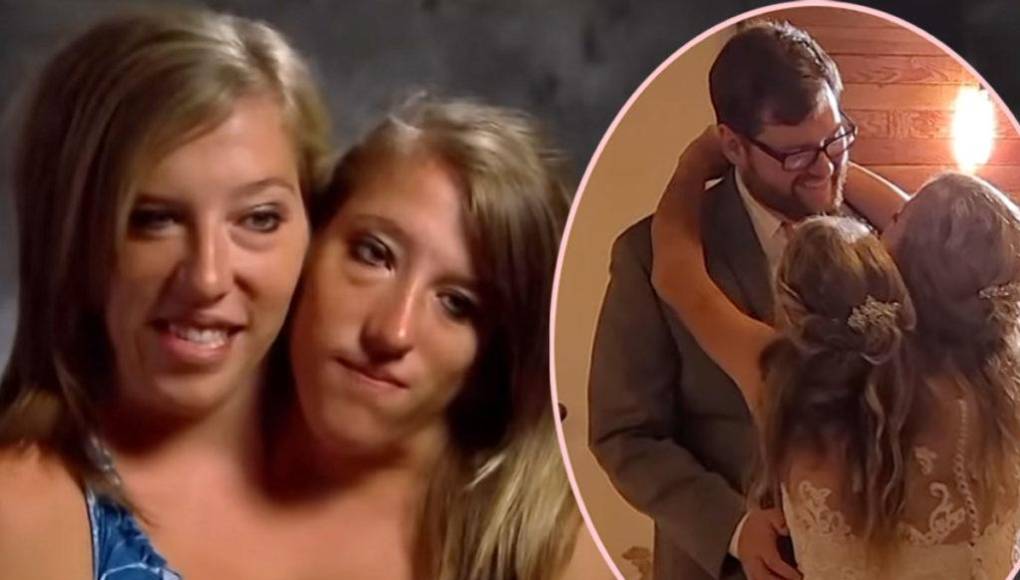 Educadoras de quinto grado por profesión, Abby y Brittany han mostrado al mundo que, con determinación, todo es posible. Desde obtener su licencia de conducir hasta graduarse de la universidad, han conquistado cada desafío.