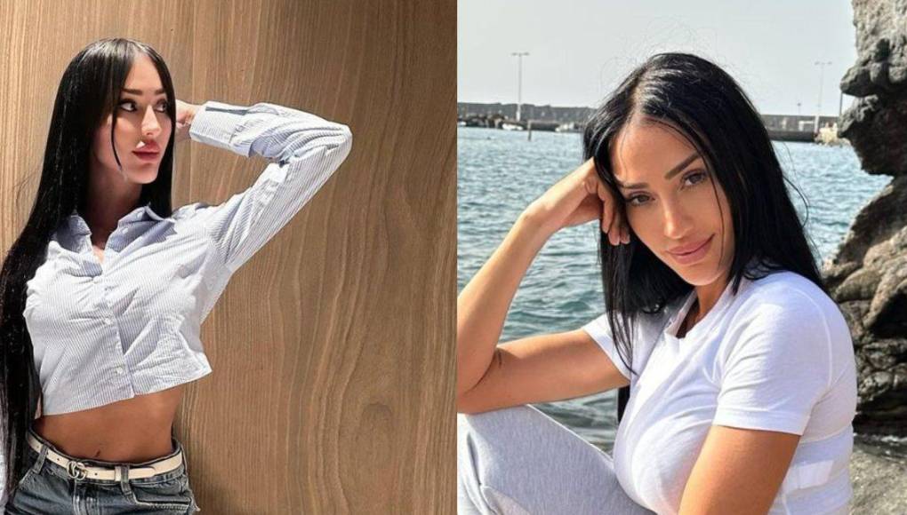 Aurah Ruiz es una modelo y esposa de un exjugador del Real Madrid que se encuentra en Honduras y en las últimas horas se conoció un accidente que sufrió en el territorio hondureño.