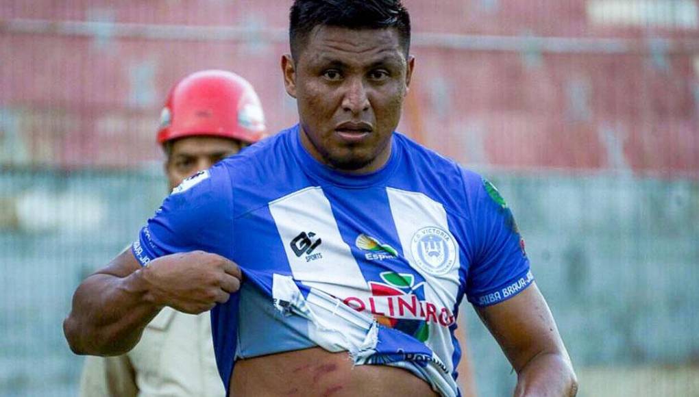 Frelys López muestra las secuelas que le dejó una entrada de un jugador del Real España. En el Victoria protestaron en las redes sociales ya que en esa acción no se sancionó falta. 