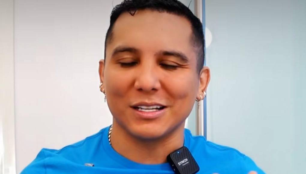 Aunque algunos de sus seguidores aplaudieron su decisión y lo apoyaron, otros opinaron que no era necesario modificar su rostro, ya que ahora “lucía irreconocible”.