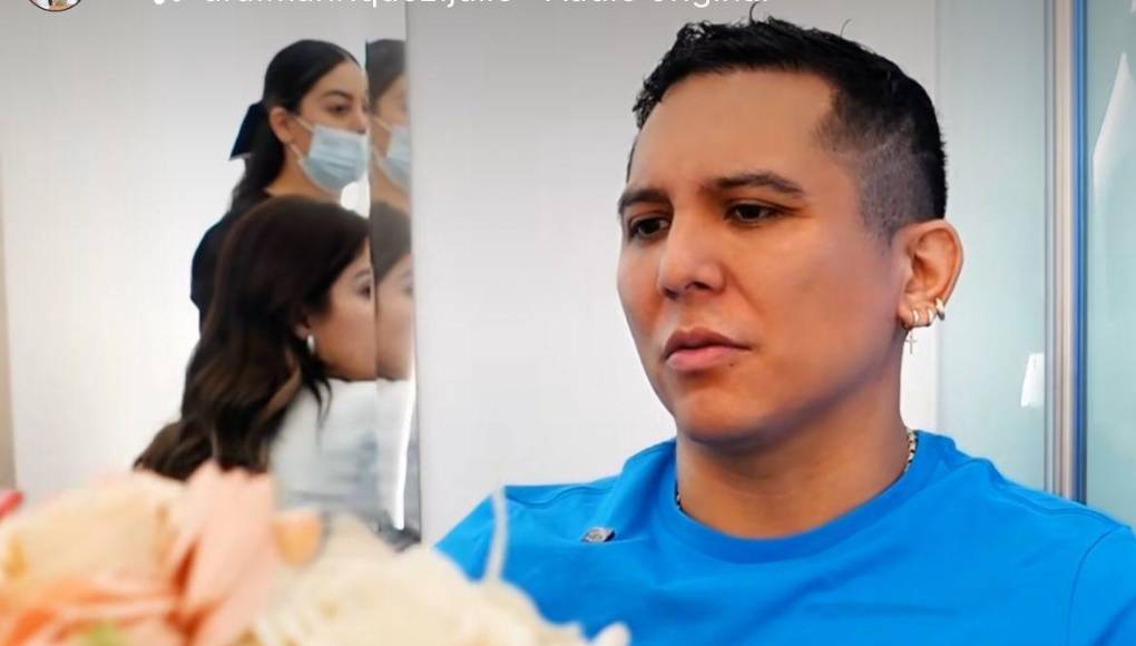 La perfilación de nariz y mandíbula no es la única intervención a la que se ha sometido el intérprete de ‘Borracho de amor’. En 2021.