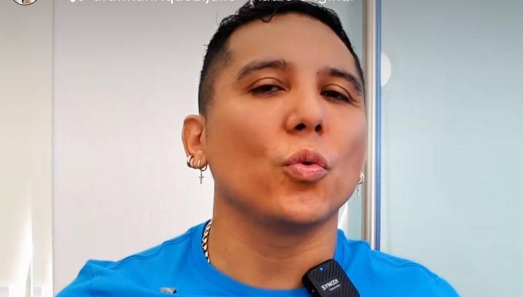 Reveló que usaba bótox ocasionalmente para mantener una apariencia más juvenil.