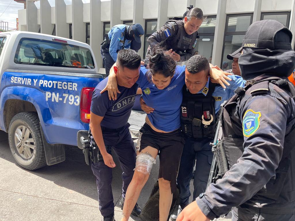 Reclusas heridas durante masacre en PNFAS se recuperan en el Hospital Escuela