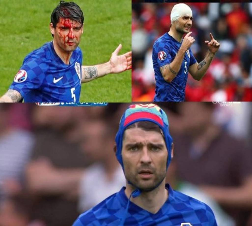 Corluka ha demostrado ser un verdadero guerrero, todo lo que ha sufrido pero no ha dejado de defender los colores de su selección.