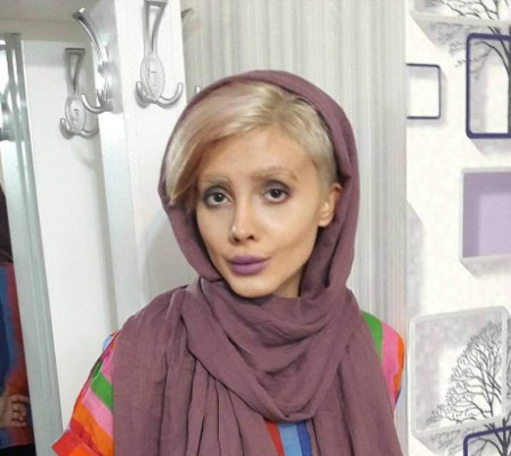 Según el sitio sabzpendar.com Sahar ha utilizado su inusual aspecto como un método para ganar seguidores en sus redes.<br/><br/>