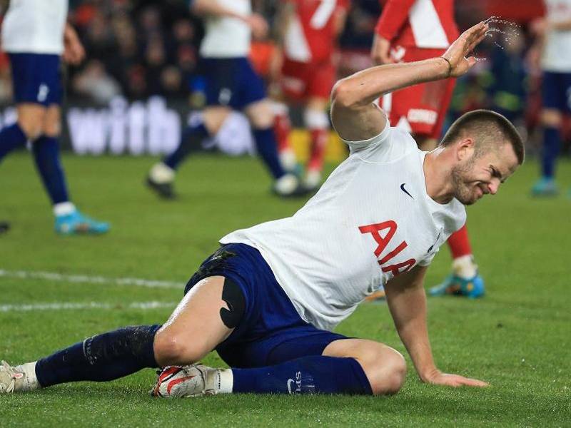 Los jugadores del Tottenham reaccionaron frustrados tras quedar eliminados de la FA Cup.